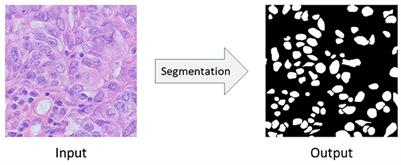 NuSegDA: Domain adaptation for nuclei segmentation